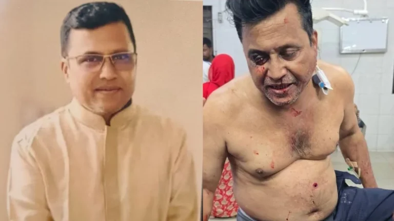 কুষ্টিয়ায় আওয়ামী লীগ নেতা গুলিবিদ্ধ